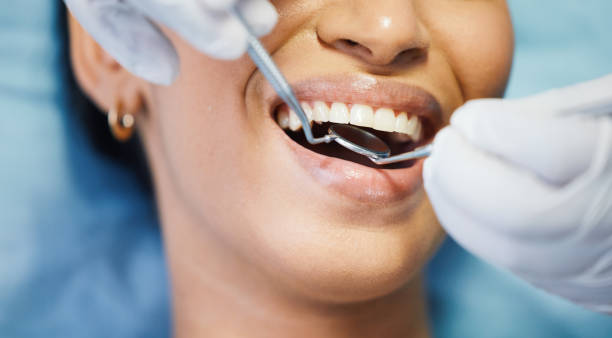Best Emergency Root Canal Treatment in Old River Winfree, TX